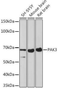 Western blot analysis of extracts of various cell lines, using Anti-PAK3 Antibody [ARC1955] (A307726) at 1:1,000 dilution. The secondary antibody was Goat Anti-Rabbit IgG H&L Antibody (HRP) at 1:10,000 dilution.