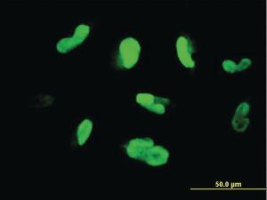 Anti-MAK Mouse Monoclonal Antibody [clone: 3E5]