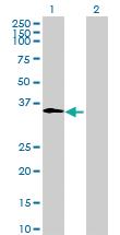 Anti-CLEC1A Mouse Polyclonal Antibody