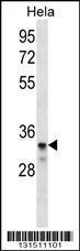 Anti-LDLRAD2 Rabbit Polyclonal Antibody (Biotin)