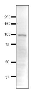 Anti-ADA3 Antibod