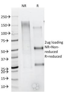 SDS-PAGE analysis of Anti-CD79b Antibody [IGB/1844] under non-reduced and reduced conditions; showing intact IgG and intact heavy and light chains, respectively. SDS-PAGE analysis confirms the integrity and purity of the Antibody