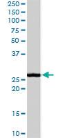 Anti-GSTM1 Goat Polyclonal Antibody