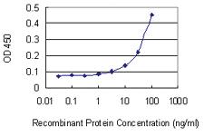 Anti-RABEP1 Mouse Monoclonal Antibody [clone: 3H6]