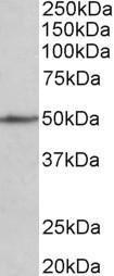 Anti-CADM1 antibody