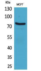 Western blot analysis of MCF7 cells using Anti-CEACAM5 Antibody