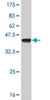 Anti-PRKDC Mouse Monoclonal Antibody [clone: 1B9]