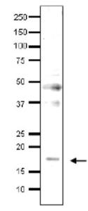 Anti-MED9 Antibody