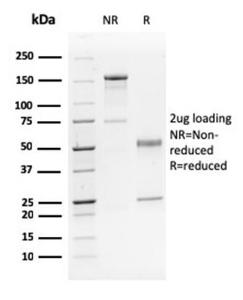 SDS-PAGE analysis of Anti-p63 Antibody [TP63/2428] under non-reduced and reduced conditions; showing intact IgG and intact heavy and light chains, respectively. SDS-PAGE analysis confirms the integrity and purity of the antibody.