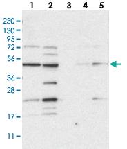 Anti-NAPEPLD Rabbit Polyclonal Antibody