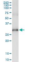 Anti-RNF144B Polyclonal Antibody Pair