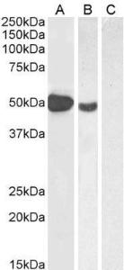 Anti-FOXP3 Antibody (A82808) (1µg/ml) staining of Human Muscle (A), (2µg/ml) MOLT4 (B) and (1µg/ml) negative control Pancreas (C) lysate (35µg protein in RIPA buffer). Detected by chemiluminescence.