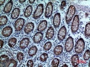 Immunohistochemical analysis of paraffin-embedded human colon using Anti-CEACAM5 Antibody