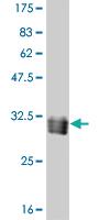 Anti-TAF11 Mouse Monoclonal Antibody [clone: 3G6]