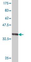 Anti-TMPRSS3 Mouse Monoclonal Antibody [clone: 2E1]