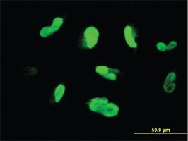 Anti-MAK Mouse Monoclonal Antibody [clone: 3E5]