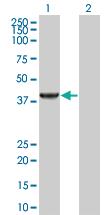 Anti-PIPOX Mouse Polyclonal Antibody