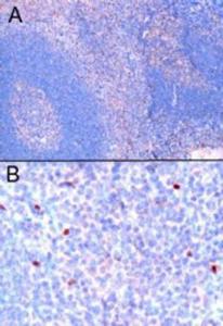 Anti-FOXP3 Antibody (A82808) (1µg/ml) staining of paraffin embedded Human Tonsil. Microwaved antigen retrieval with Tris/EDTA buffer pH9, HRP-staining. A) Nuclear staining of scattered cells in the interfollicular area. B) High magnification of positive cells.