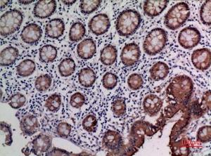 Immunohistochemical analysis of paraffin-embedded human colon using Anti-CEACAM5 Antibody