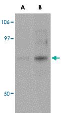 Anti-ACBD3 Rabbit Polyclonal Antibody