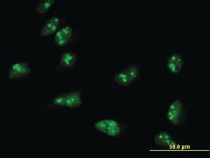 Anti-TASP1 Mouse Monoclonal Antibody [clone: 3E10]