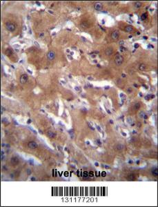 Anti-RASSF10 Rabbit Polyclonal Antibody (HRP (Horseradish Peroxidase))