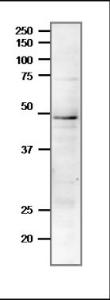 Anti-Rad51 Antibody