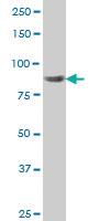 Anti-RPS6KA6 Mouse Monoclonal Antibody [clone: 8D2]