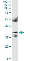 Anti-FOSL2 Polyclonal Antibody Pair