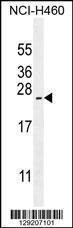 Anti-ARL17A Rabbit Polyclonal Antibody