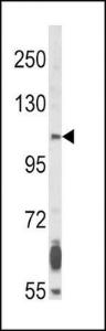 Anti-FGFR2 Rabbit Polyclonal Antibody (HRP (Horseradish Peroxidase))