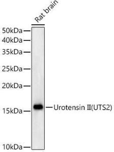 Western blot analysis of Rat brain, using Anti-Urotensin II Antibody [ARC59263] (A309958) at 1:500 dilution