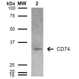 Western blot analysis of human Lymphoblastoid cell line (Raji) showing detection of 33-35 kDa CD74 protein using Anti-CD74 Antibody [6D9] (A304843) at 1:1000 for 2 hours at room temperature