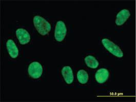 Anti-FBXO11 Mouse Monoclonal Antibody [clone: 4C12]