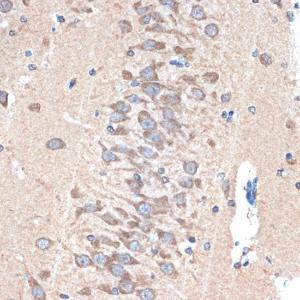 Immunohistochemistry analysis of paraffin-embedded rat brain using Anti-PAK3 Antibody [ARC1955] (A307726) at a dilution of 1:100 (40x lens). Perform microwave antigen retrieval with 10 mM Tris/EDTA buffer pH 9.0 before commencing with IHC staining protocol.