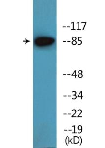 Anti-ATRIP Rabbit Polyclonal Antibody