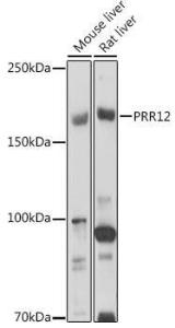 Western blot analysis of extracts of various cell lines, using Anti-PRR12 Antibody (A306018) at 1:1000 dilution