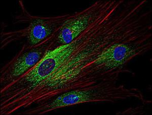 Antibody anti-SYK SYK-01 100 µg