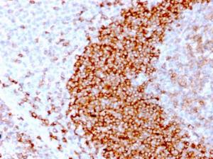 Antibody anti-CD79B IGB3170R BSA 100 µg