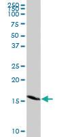 Anti-GEMIN7 Rabbit Polyclonal Antibody