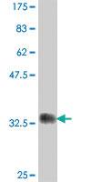 Anti-UBE2G2 Mouse Polyclonal Antibody