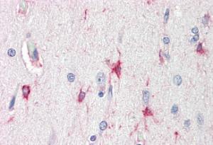 Anti-BAG3 Antibody (A84412) (5 µg/ml) staining of paraffin embedded Human Cortex Steamed antigen retrieval with citrate buffer pH 6, AP-staining