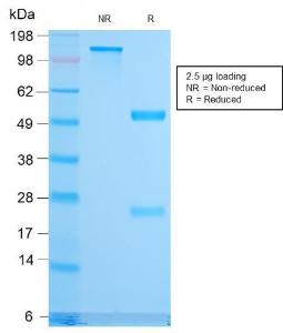 Antibody anti-CD79B IGB3170R BSA 100 µg