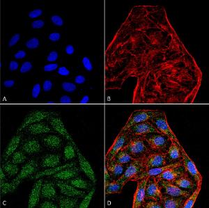 Immunocytochemistry/Immunofluorescence analysis of human cervical cancer cell line (HeLa), fixed in 4% formaldehyde for 15  min at room temperature, using Anti-CD74 Antibody [6D9] (A304843), at 1:100 for 60  minutes at room temperature.