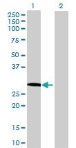 Anti-GOSR1 Mouse Polyclonal Antibody