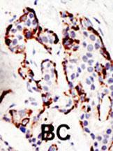 Anti-SUV39H2 Rabbit Polyclonal Antibody (HRP (Horseradish Peroxidase))