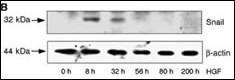 Anti-SNAI1 Rabbit Polyclonal Antibody (FITC (Fluorescein Isothiocyanate))