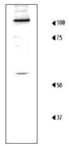 Anti-Rpn1 Antibody