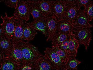 Antibody anti-SYK SYK-01 100 µg