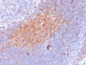 Anti-TAPA1 antibody